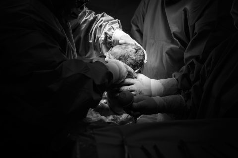 A photo of an Cesarean section