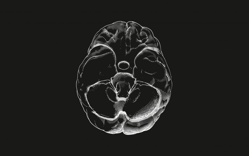Photo illustration of a brain.
